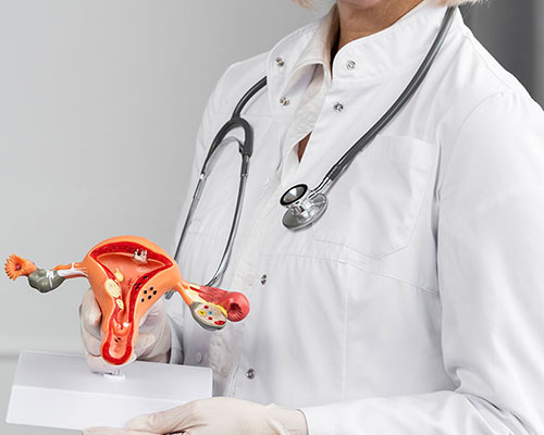 Uterine Fibroids